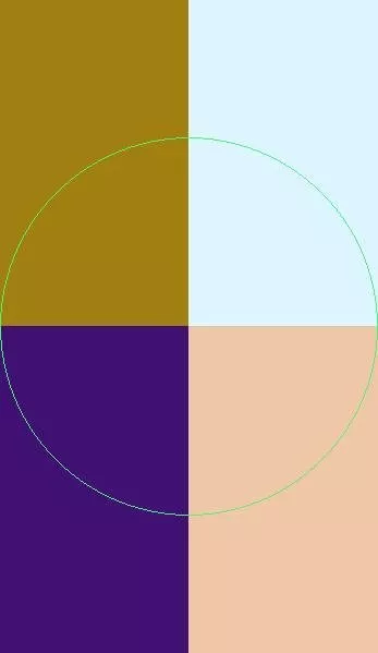 Caecus et tum. Abdo ex lenis.